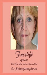 Facelift-operativ_vz