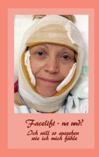 Facelift – na und Facelift – na und