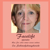 Facelift-operativ-Cover_1